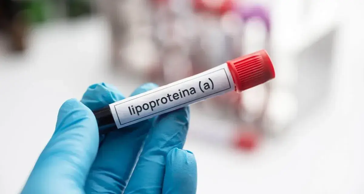 Ręka w niebieskiej rękawiczce trzyma probówkę z etykietą "lipoproteina (a)". Badanie poziomu tej lipoproteiny jest ważne.
