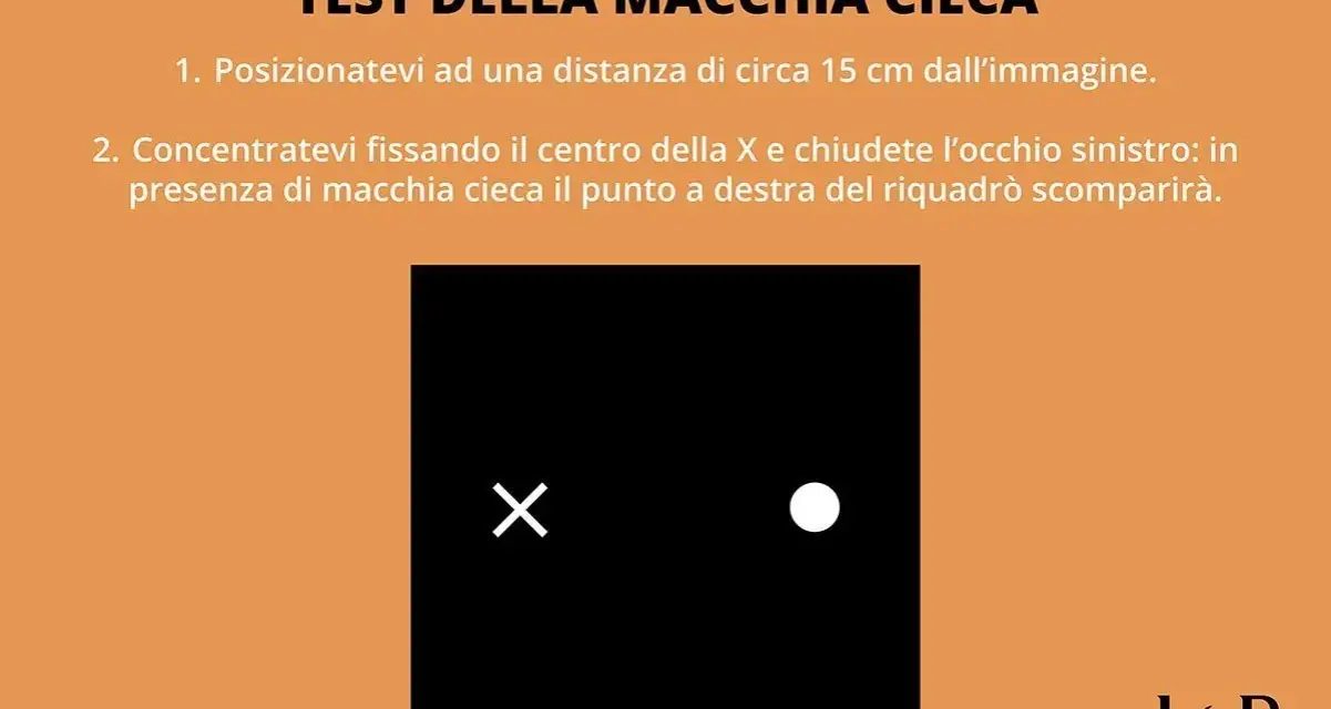 Test della macchia cieca: fissa la X, chiudi l'occhio sinistro. Il punto a destra del riquadro nero potrebbe scomparire, come se fosse vedere ombrato da un occhio.