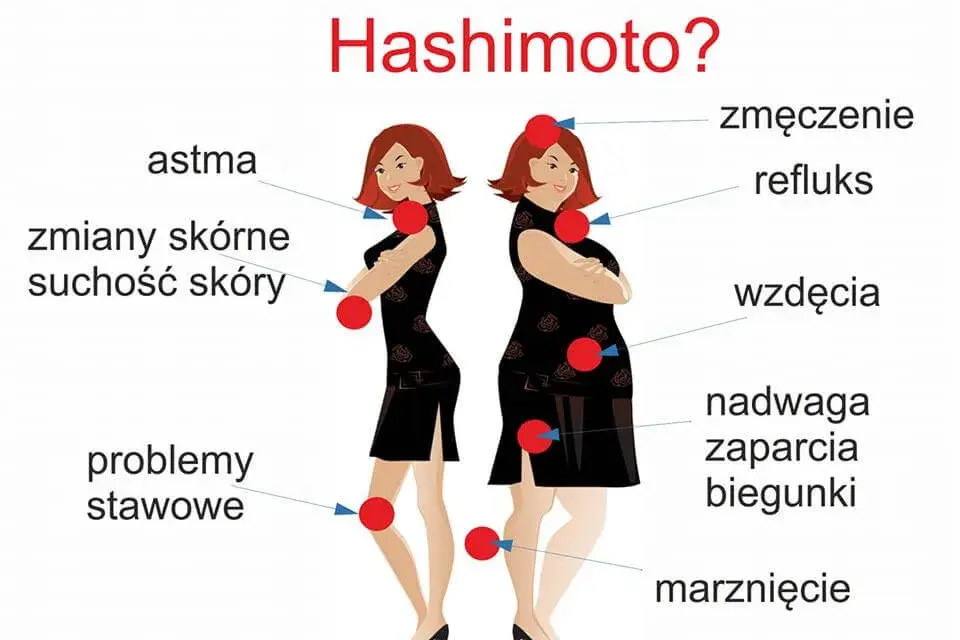 Hashimoto objawy psychiczne - jak rozpoznać i zrozumieć ich wpływ