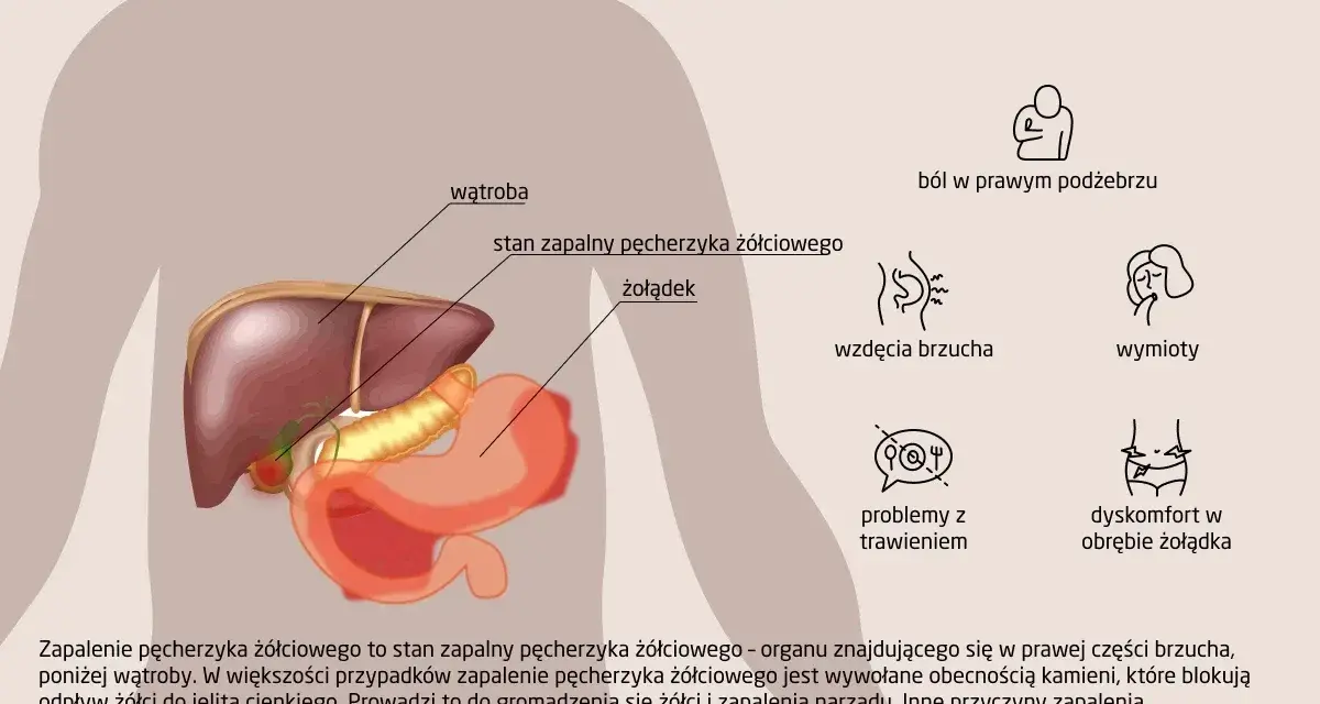 Anatomia człowieka z zaznaczonym pęcherzykiem żółciowym i objawami jego zapalenia: ból, wzdęcia, wymioty, problemy z trawieniem.
