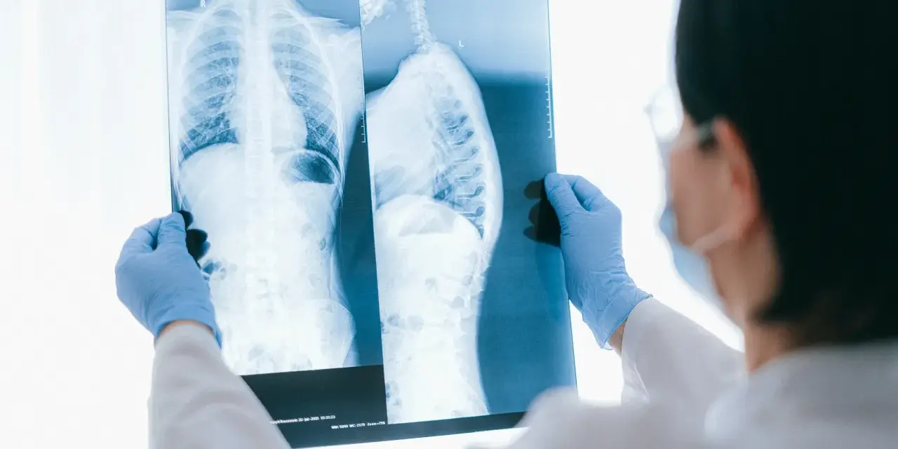 Lekarz w niebieskich rękawiczkach analizuje RTG klatki piersiowej i kręgosłupa, szukając oznak osteoporozy.