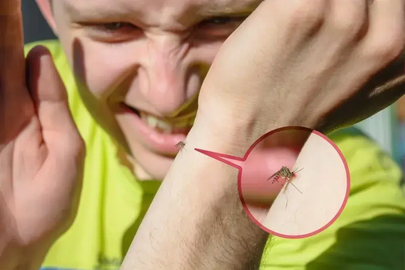 Bąble jak po ugryzieniu komara alergia – objawy i skuteczne leczenie