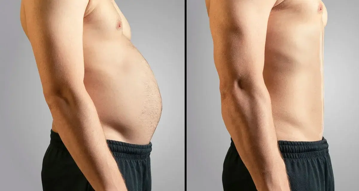Antes y después: abdomen con grasa y abdomen tonificado. Un cambio radical para eliminar grasa abdominal.