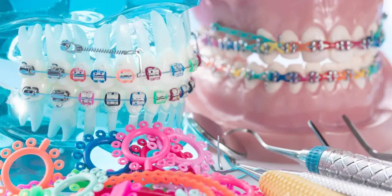 Kolorowe ligatury i metalowe zamki na modelach szczęk, obok narzędzi dentystycznych. To aparat ceramiczny w akcji!