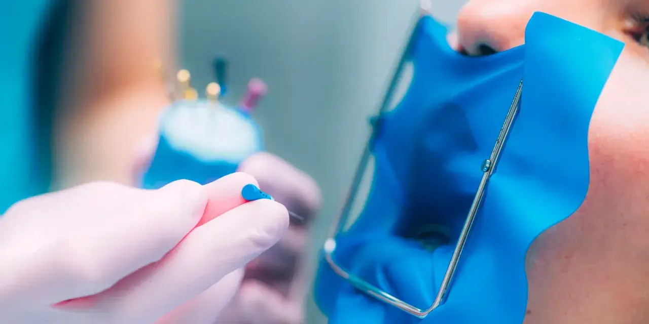 Dentysta przygotowuje lekarstwo w zębie przed leczeniem kanałowym, używając narzędzi i koferdamu.