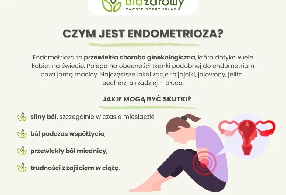 Endometrioza objawy forum: co naprawdę musisz wiedzieć o bólu