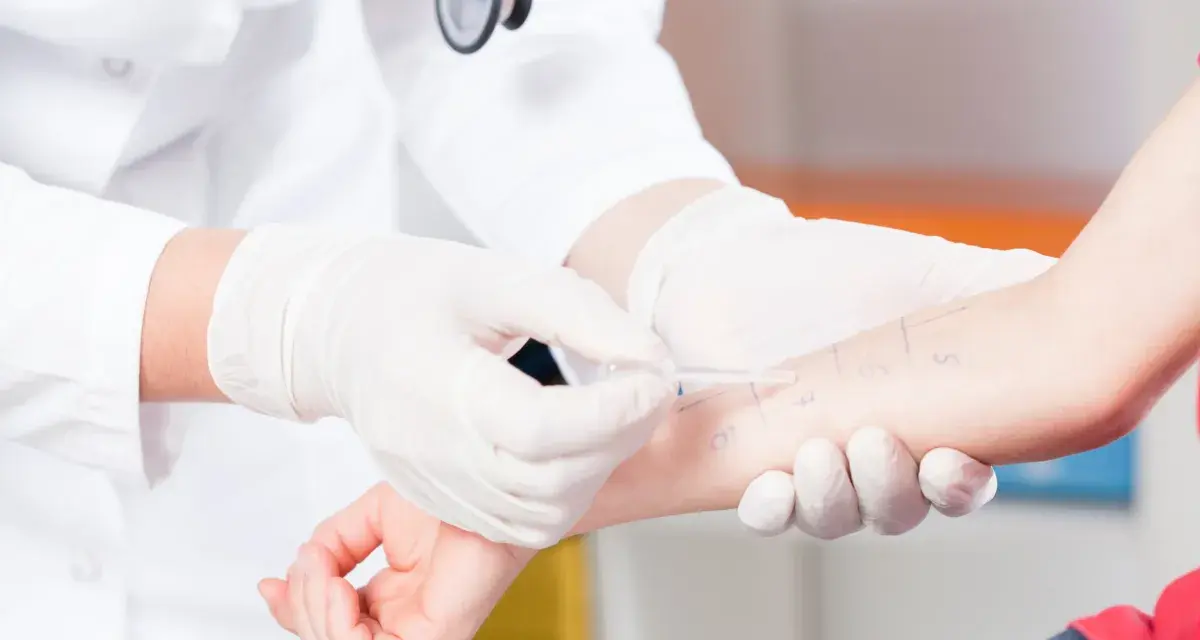 Lekarz w białej rękawiczce wykonuje test skórny na ramieniu pacjenta.