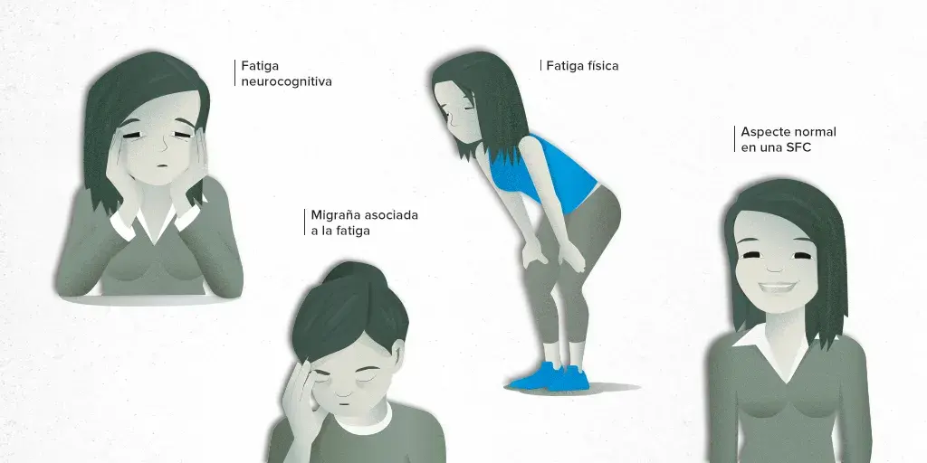 Síntomas de fatiga crónica: ¿Es más que cansancio normal?