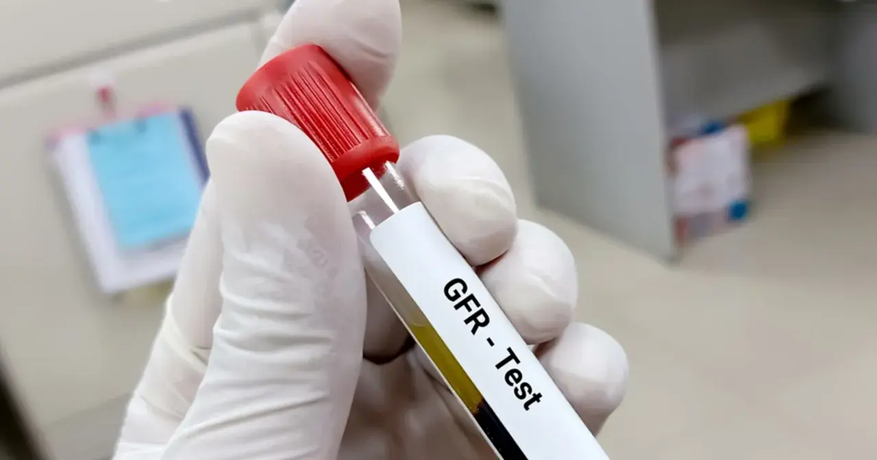 Rękawiczka trzyma probówkę z oznaczeniem "GFR - Test". To jedno z badań na nerki, które ocenia ich pracę.