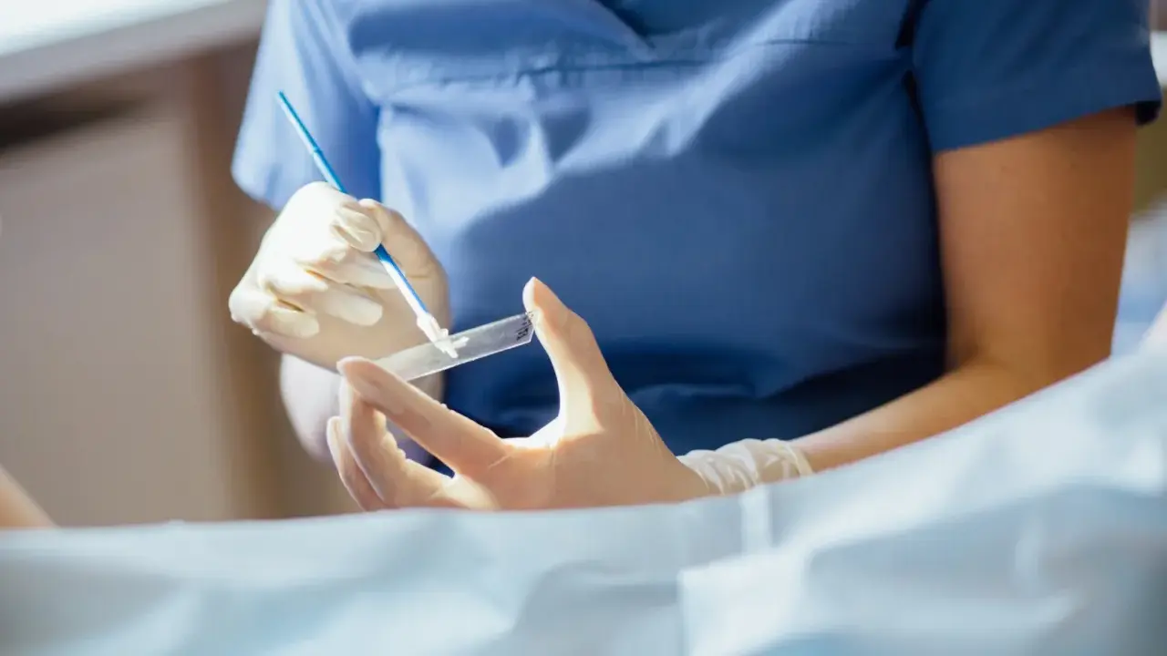 Lekarz w rękawiczkach przygotowuje preparat do badania cytologicznego, które pozwala wykryć zmiany w komórkach.