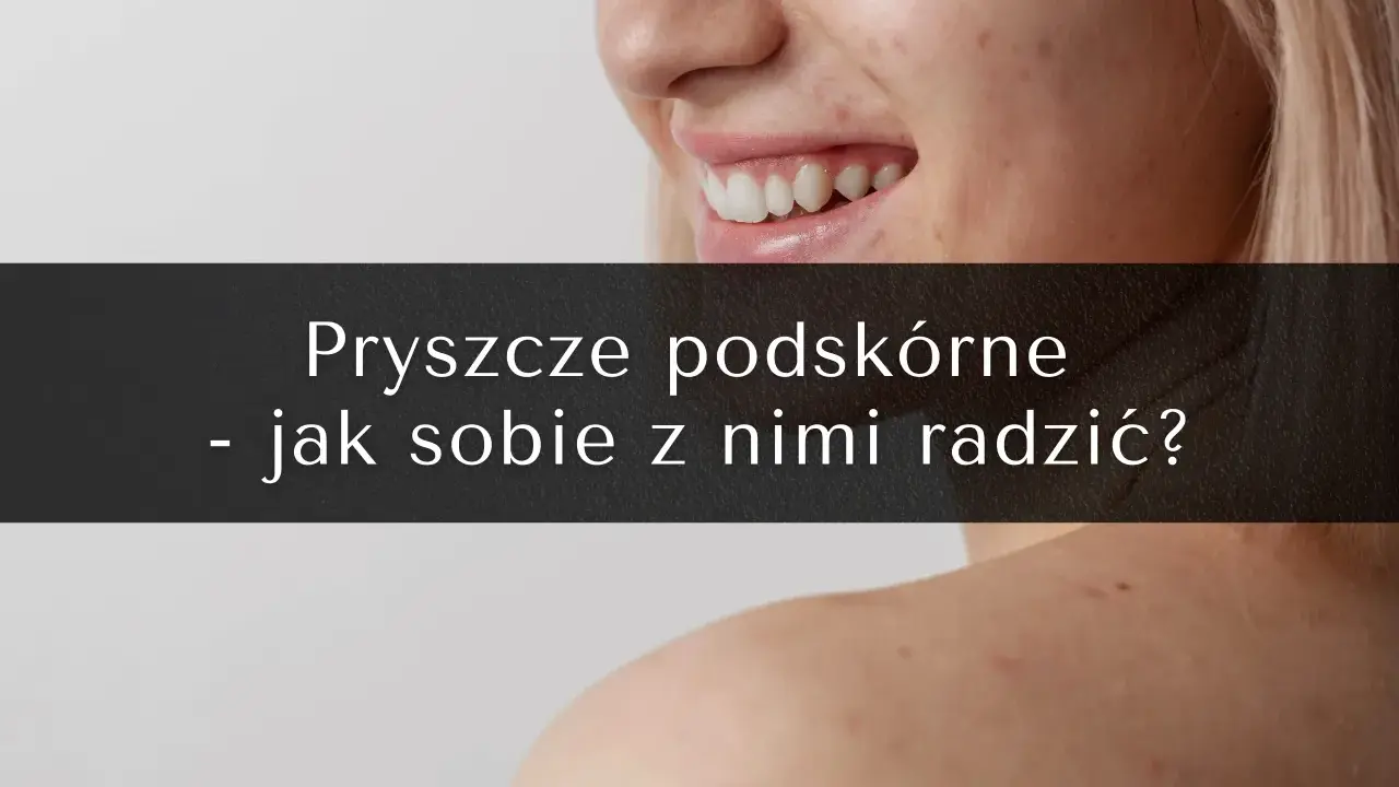 Bolesny pryszcz podskórny: Jak się pozbyć i szybko złagodzić ból?