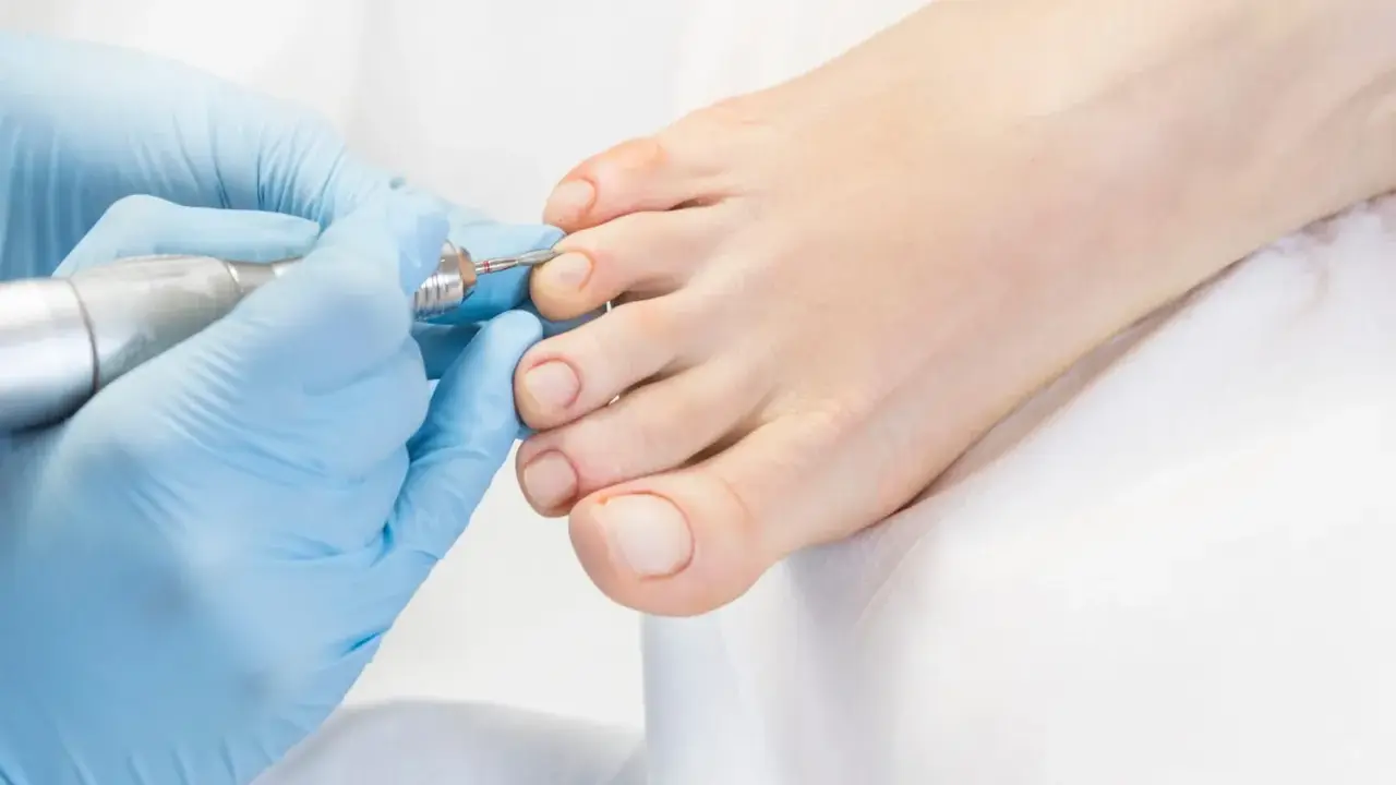 Un podologue réalise une pédicure avec un appareil rotatif sur les ongles d'un pied.