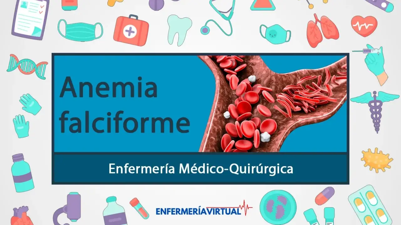 Anemia falciforme: glóbulos rojos con forma de hoz bloquean el flujo sanguíneo. Ilustración médica con iconos de salud.