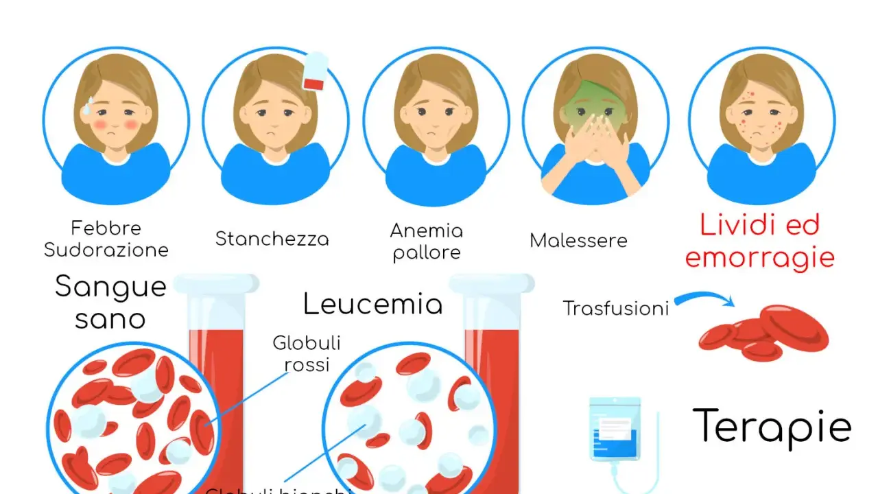 Leucemia fulminante: febbre, stanchezza, anemia, malessere, lividi. Globuli bianchi disfunzionali. Terapie: trasfusioni, chemioterapia.