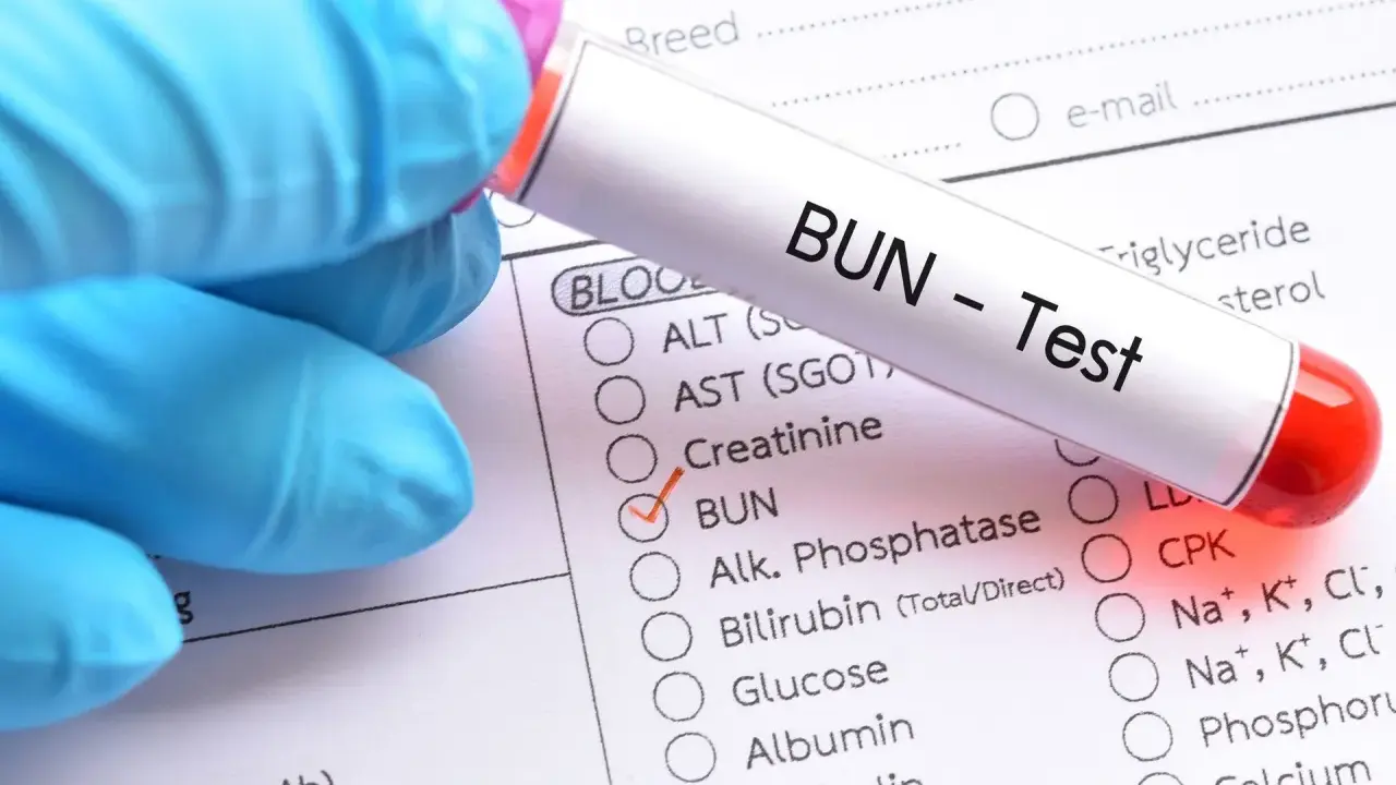Rękawiczka w niebieskiej rękawiczce trzyma probówkę z napisem "BUN - Test". Zaznaczono pole "BUN", co może wskazywać na badanie w kierunku zatrucia mocznikiem objawy.