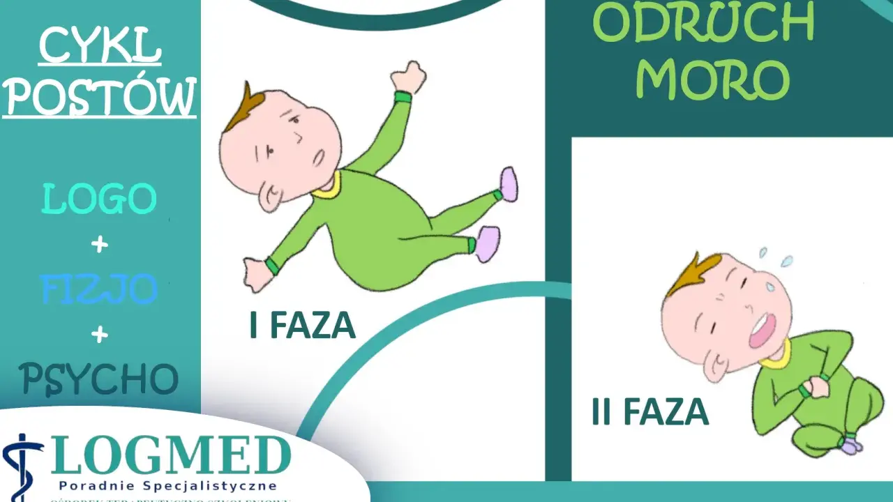 Ilustracja pokazuje odruch Moro do kiedy niemowlę reaguje na bodziec. Dwie fazy odruchu: I faza - rozłożenie rączek, II faza - przyciągnięcie rączek do siebie.
