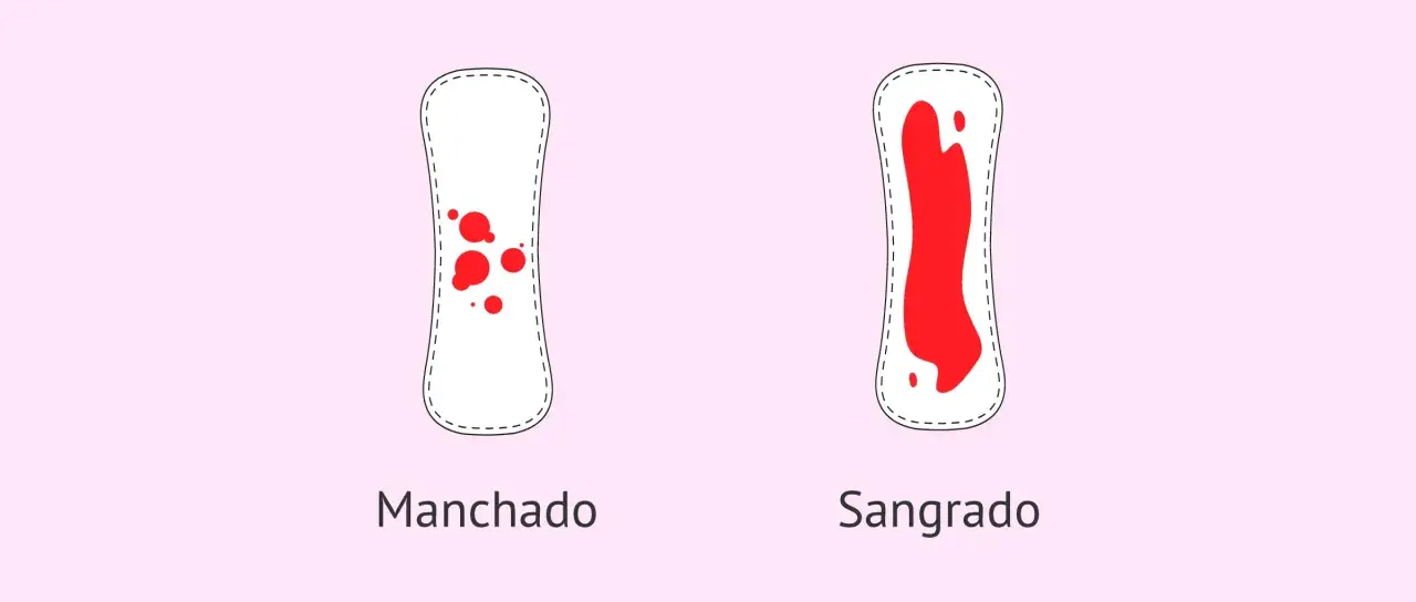Dos compresas: una con manchado leve y otra con sangrado abundante. Puede ser un signo de embarazo con la regla.