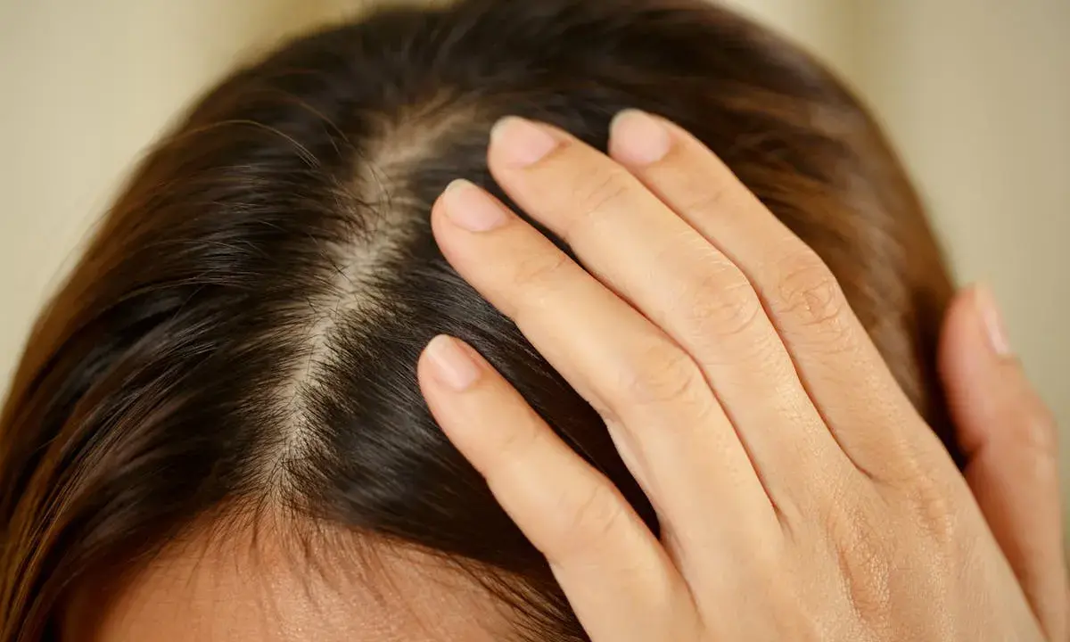Main d'une femme effleurant son cuir chevelu, peut-être pour vérifier un kyste ou une irritation.