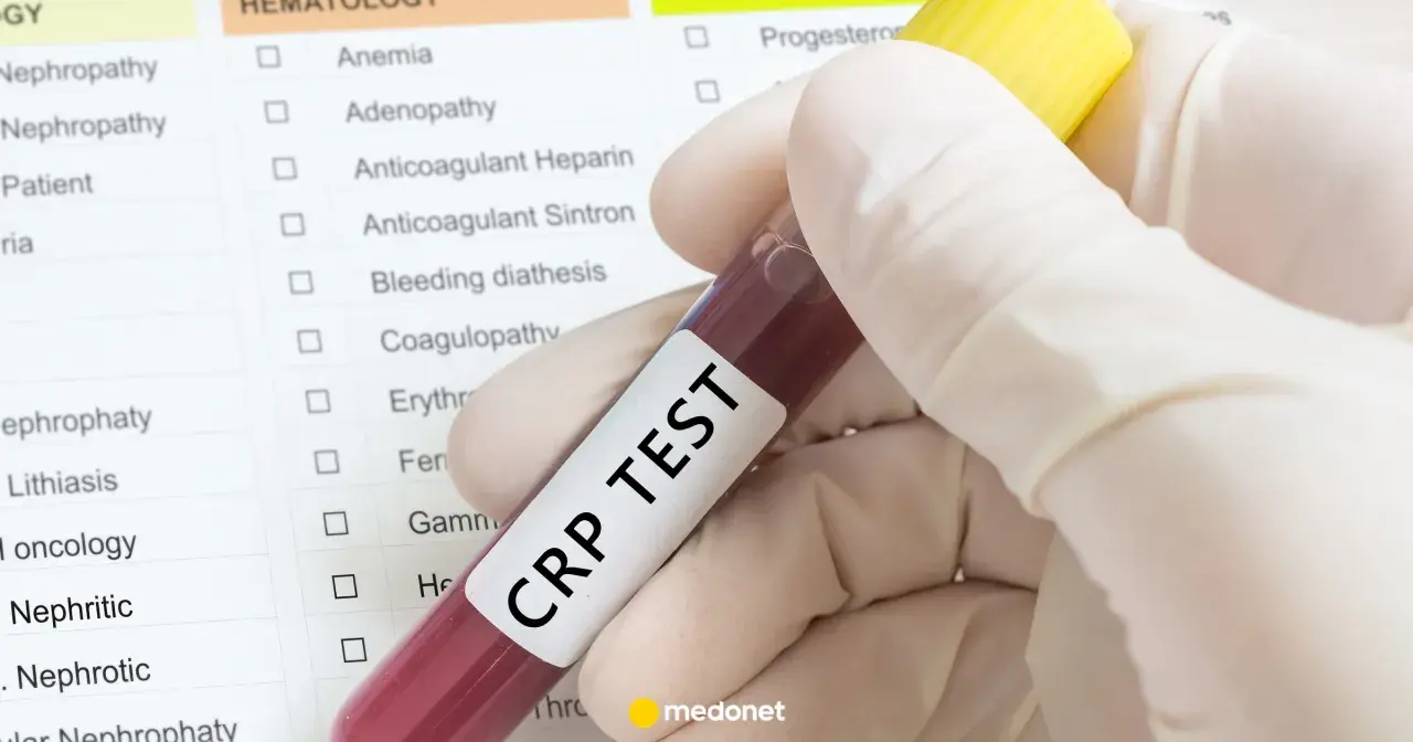 Ręka w rękawiczce trzyma probówkę z krwią z napisem "CRP TEST" na tle listy badań.