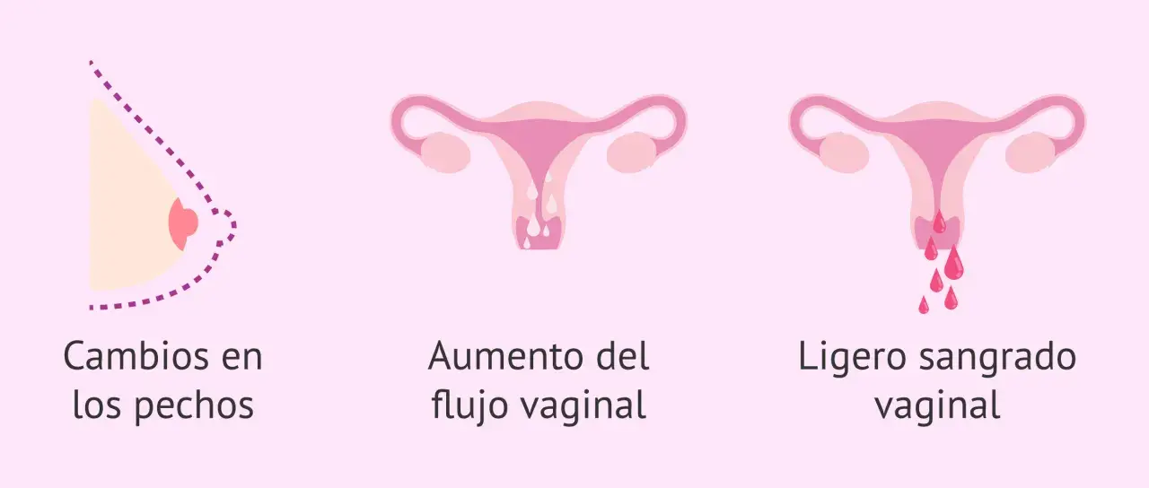 Cambios en pechos, aumento de flujo vaginal y ligero sangrado vaginal. Posible retraso menstrual.