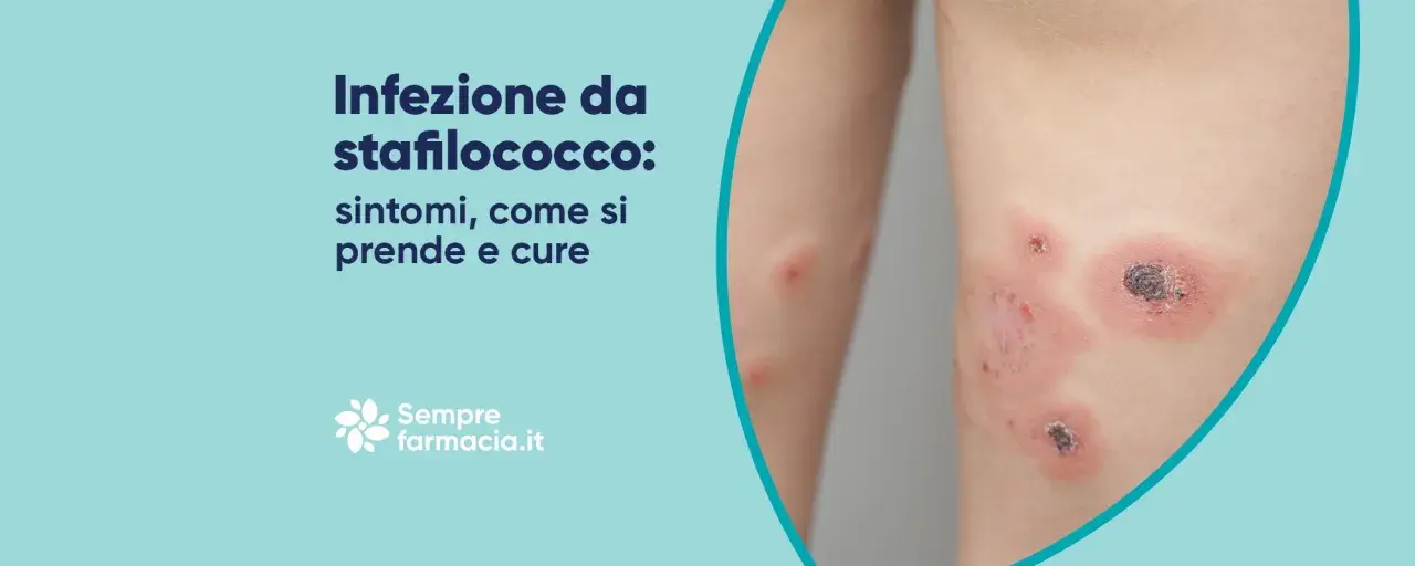 Infezione da stafilococco: cos'è, sintomi, come si prende e cure. Lesioni cutanee infette.