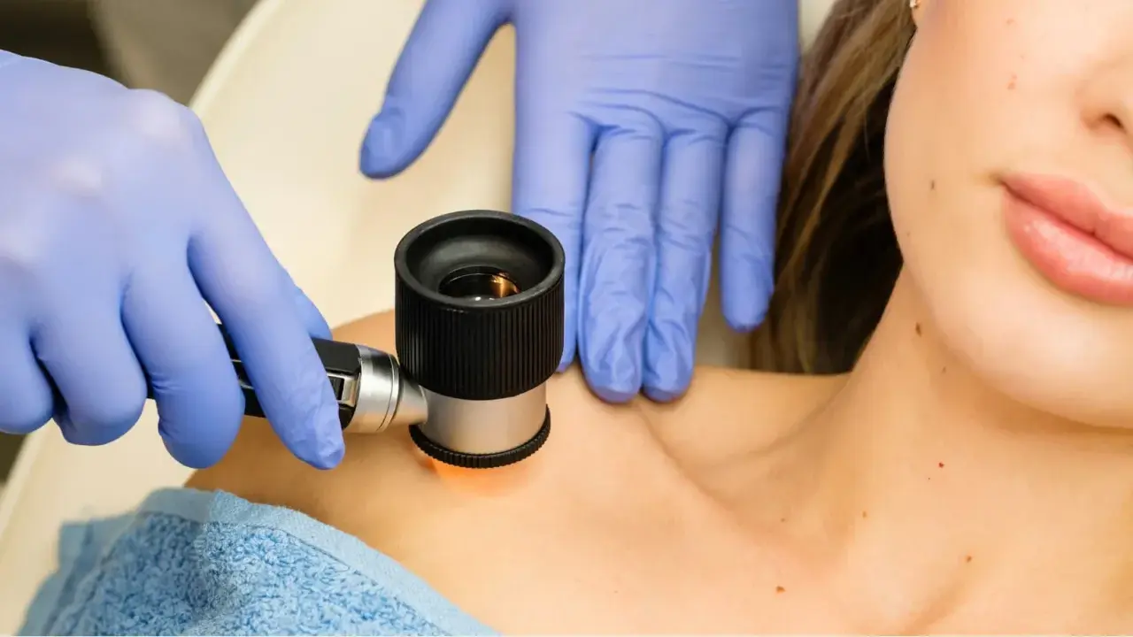 Dermatolog w niebieskich rękawiczkach bada znamię dermatoskopem na skórze pacjentki.