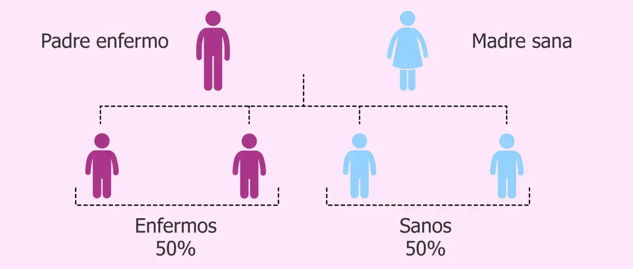Diagrama de herencia genética: padre enfermo (morado) y madre sana (azul) tienen 50% de hijos enfermos y 50% sanos.