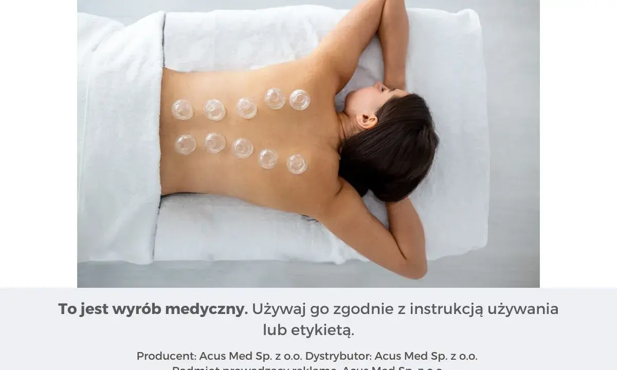 Kobieta leży na plecach, na jej kręgosłupie umieszczono przezroczyste bańki.