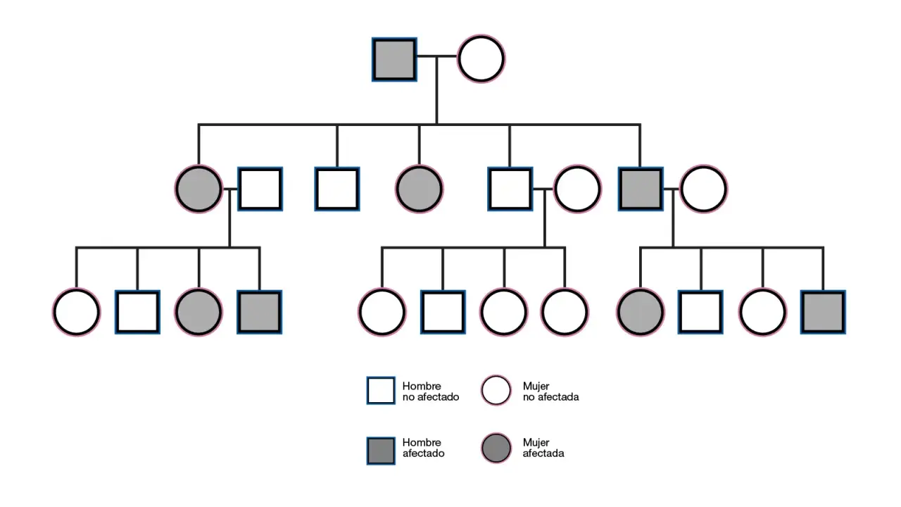Árbol genealógico que muestra la herencia dominante. Individuos afectados (cuadrados y círculos grises) y no afectados (cuadrados y círculos blancos) a través de varias generaciones.