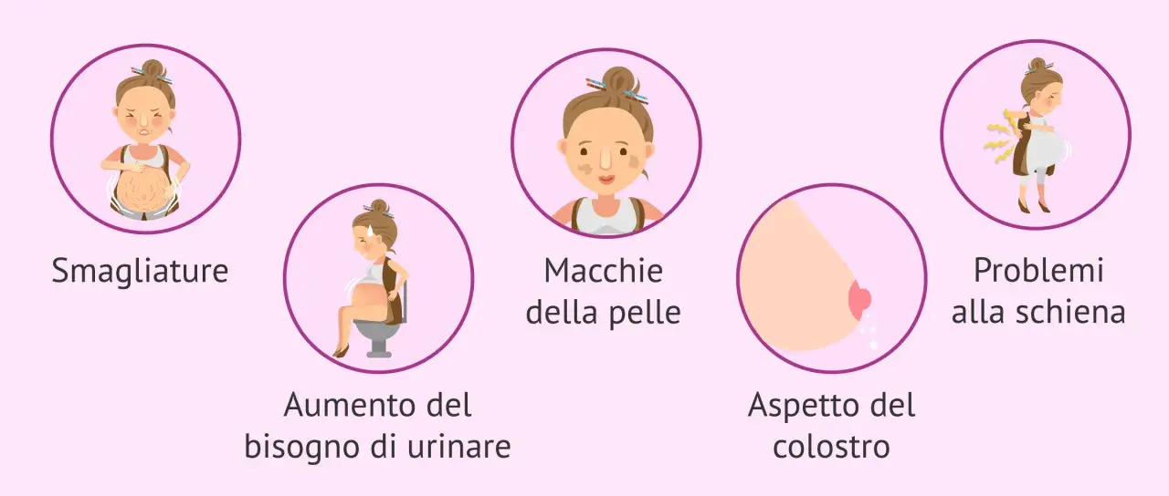 Il sesto mese di gravidanza porta smagliature, macchie sulla pelle, aumento del bisogno di urinare, colostro e problemi alla schiena.