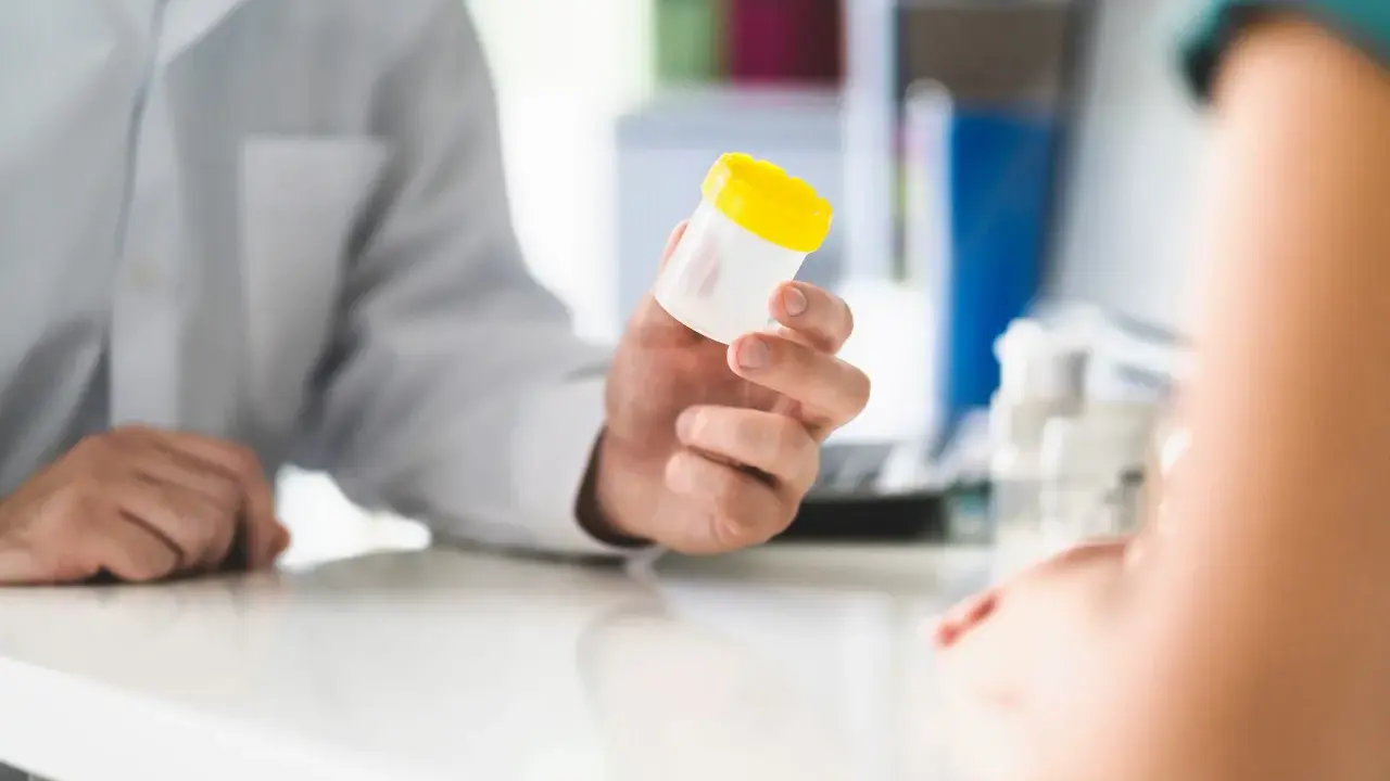 Lekarz podaje pacjentowi pojemnik na mocz, sugerując potrzebę diagnostyki w kierunku krwiomoczu, co jest pierwszym krokiem do ustalenia leczenia domowego.