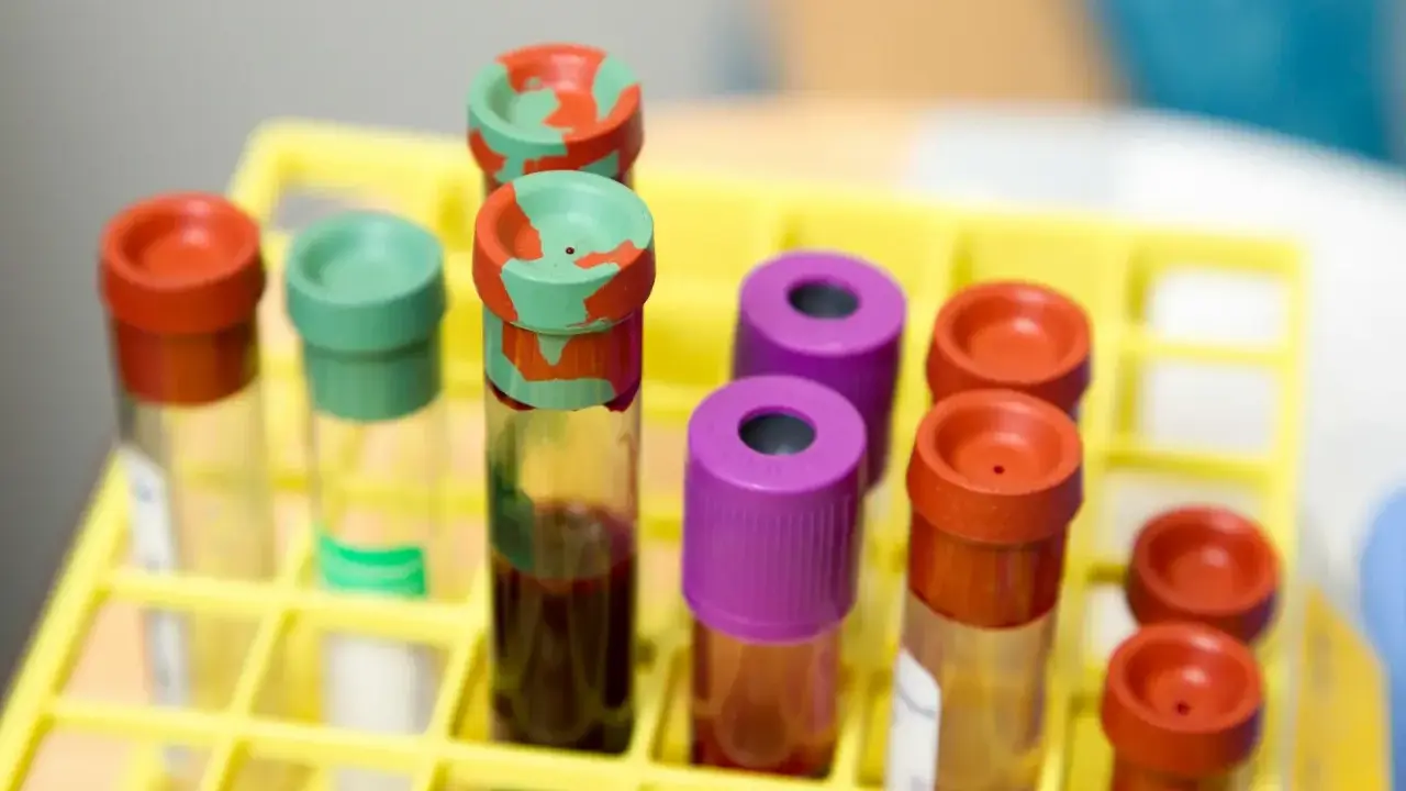 Probówki z krwią w żółtym stojaku laboratoryjnym.