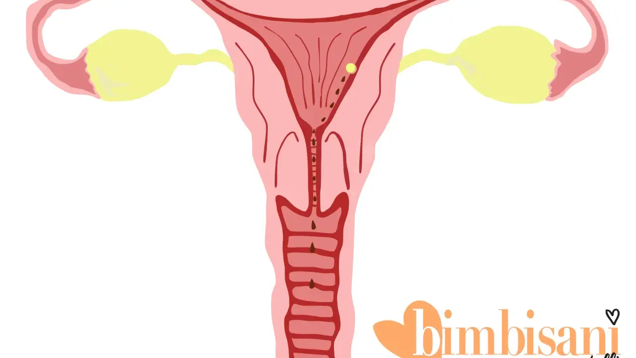 Illustrazione utero con ovuli gialli e macchie marroni, suggerendo spotting gravidanza colore.