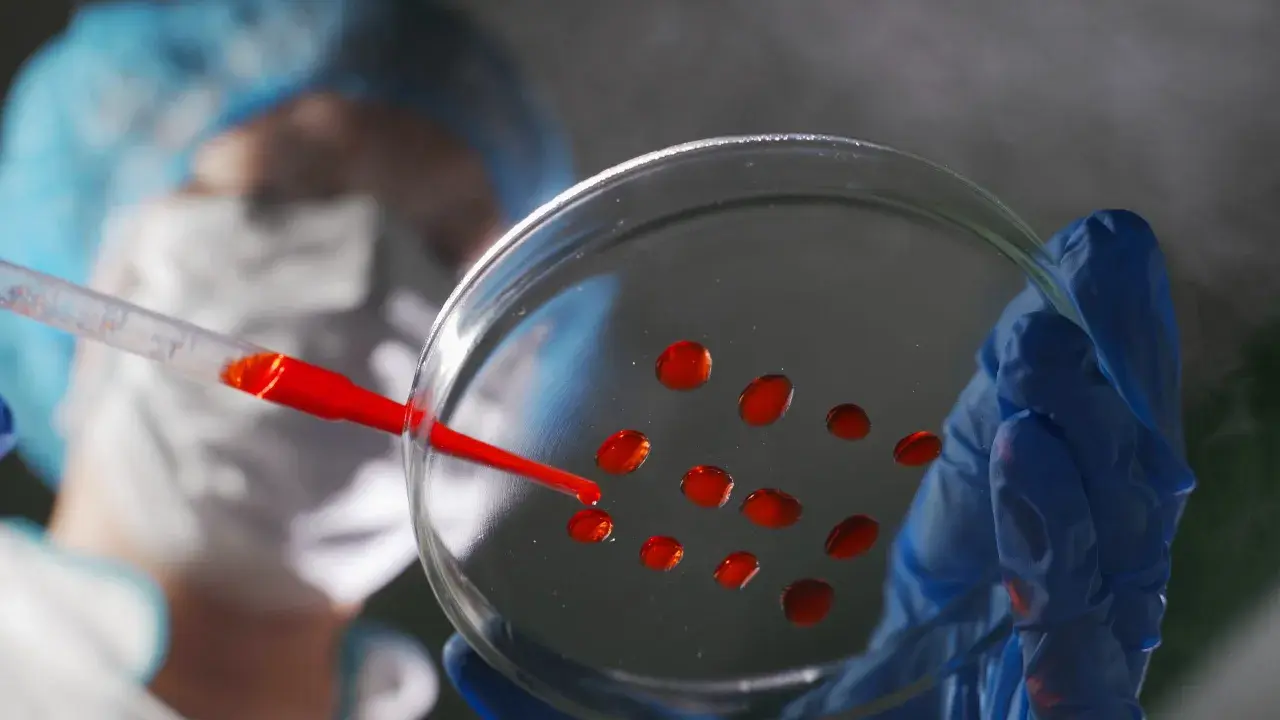Ricerca medica: gocce rosse su piastra di Petri, parte di un test per capire se hai un tumore.