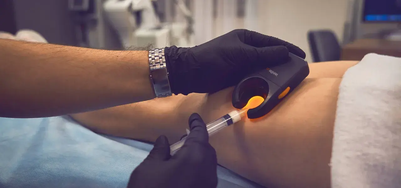 Lekarz w rękawiczkach używa urządzenia do wizualizacji żył i strzykawki. To pokazuje, na czym polega skleroterapia.