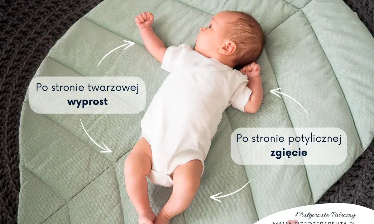 Niemowlę śpi z głową w jedną stronę, z wyprostowanymi nóżkami po stronie twarzowej i zgiętymi po potylicznej.