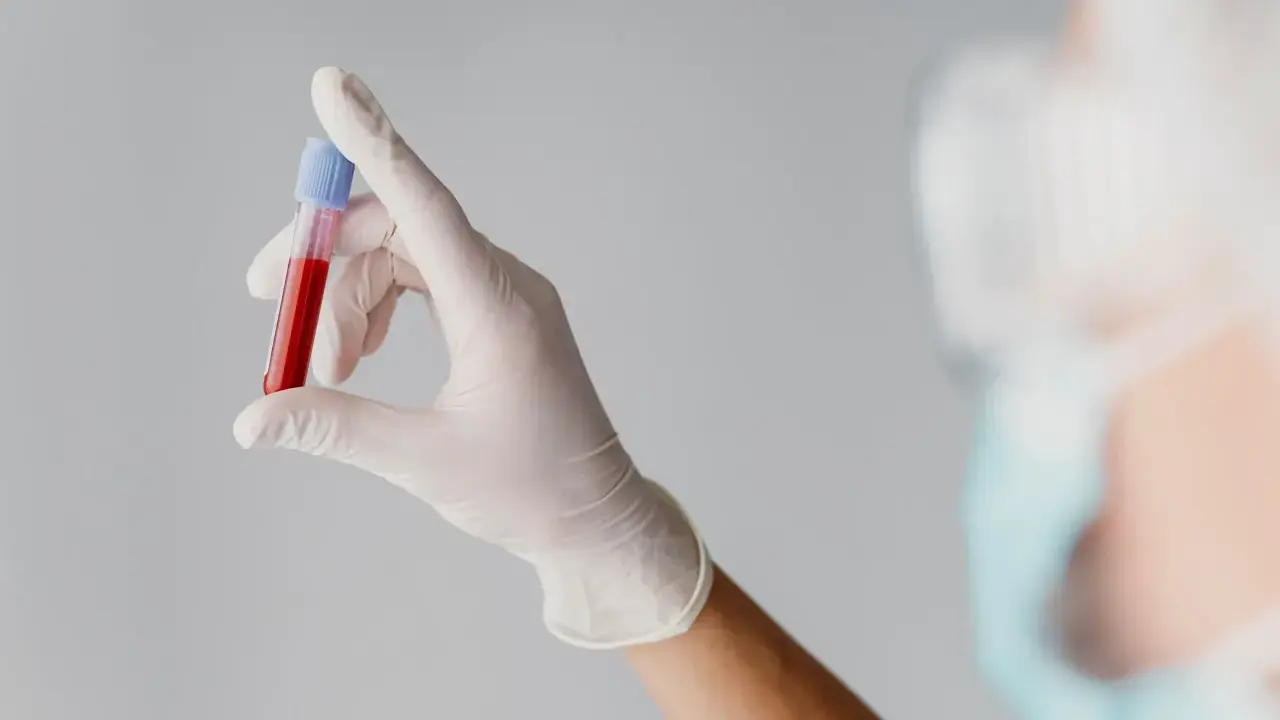 Ręka w białej rękawiczce trzyma probówkę z krwią. Wyniki wskazują na mchc niskie, co może wymagać dalszej diagnostyki.