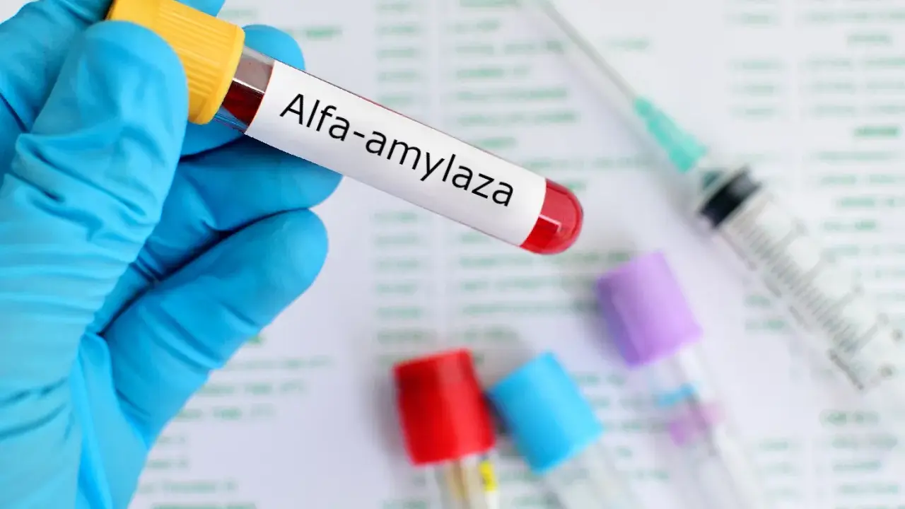 Amylaza podwyższona: co oznacza? Kiedy pilnie do lekarza?