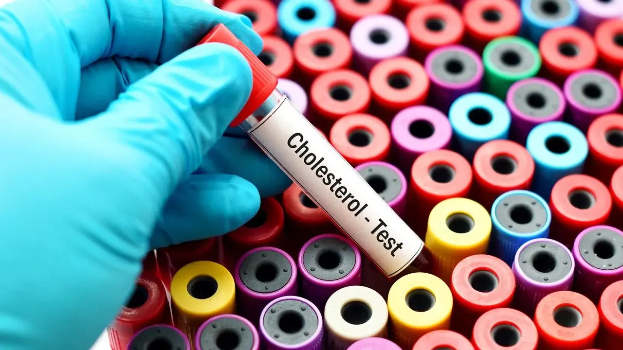 Rękawiczka trzyma probówkę "Cholesterol - Test" na tle wielu kolorowych probówek. Monakolina może wpływać na wyniki, warto to sprawdzić.