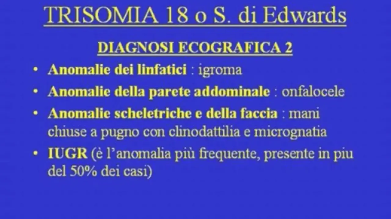Diagnosi ecografica della trisomia 18: igroma, onfalocele, mani chiuse a pugno, micrognatia e IUGR.