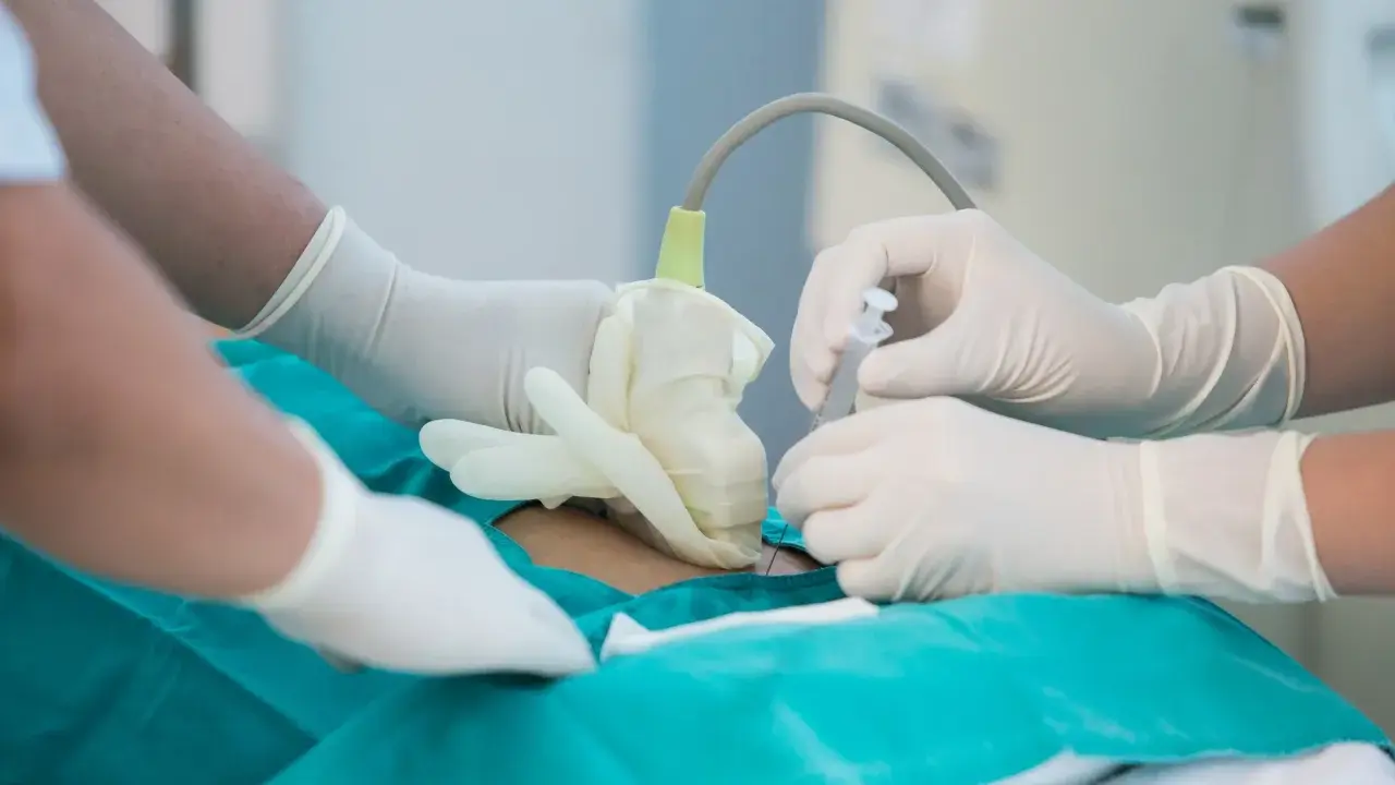 Lekarze w rękawiczkach wykonują amniopunkcję, badanie płynu owodniowego, które odpowiada na pytanie: amniopunkcja co to.