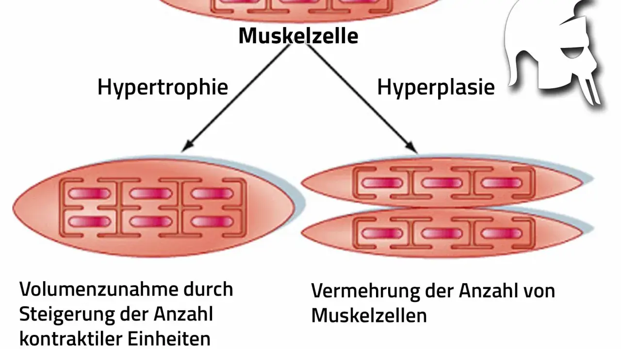 Sarkoplasmatische Hypertrophie: Muskelzelle wächst durch mehr kontraktile Einheiten. Daneben Hyperplasie: mehr Muskelzellen.
