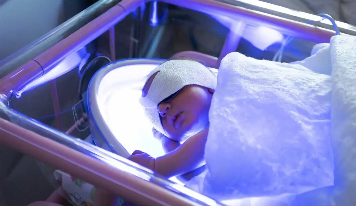 Un neonato dorme sotto luci blu per la fototerapia, con gli occhi protetti da bende.