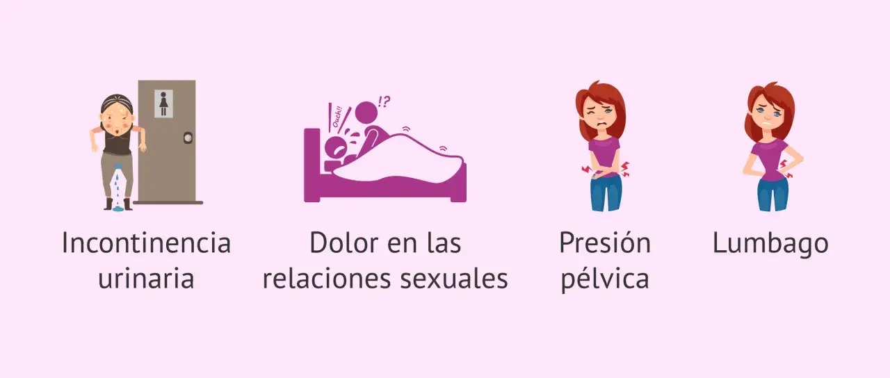 Ilustraciones de incontinencia, dolor en las relaciones sexuales, presión pélvica y lumbago, síntomas asociados al prolapso uterino.