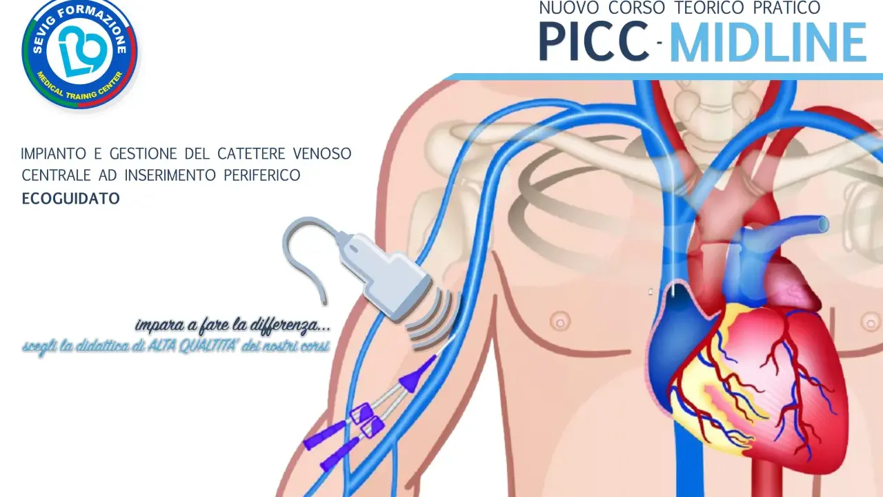 Corso pratico sull'inserimento PICC ecoguidato. Illustrazione anatomica mostra il posizionamento del catetere venoso centrale.
