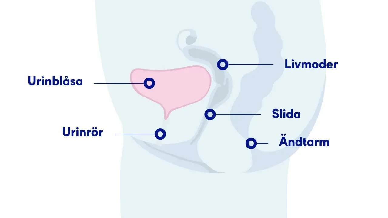 Illustration av bäckenorganen: urinblåsa, livmoder, slida, ändtarm och urinrör. Visar hur ett framfall av urinblåsan kan påverka dessa.