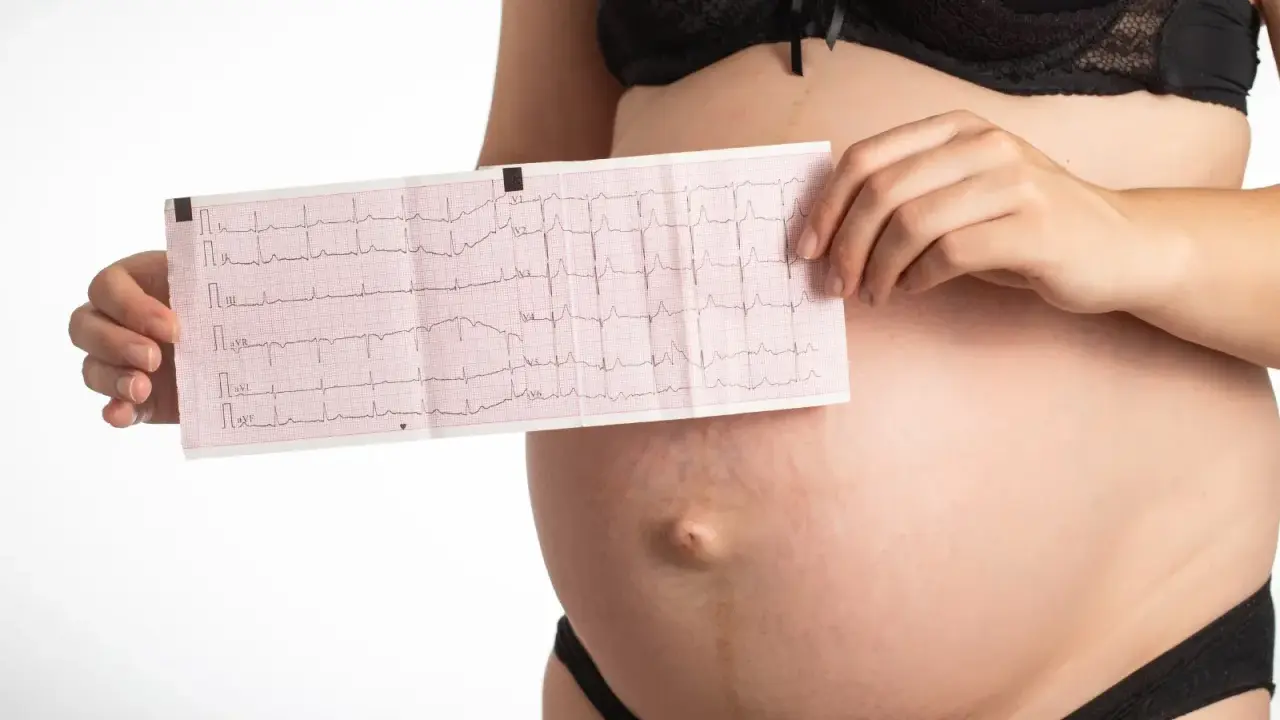 Pancia di donna incinta con elettrocardiogramma che mostra tachicardia. Monitoraggio cardiaco in gravidanza.