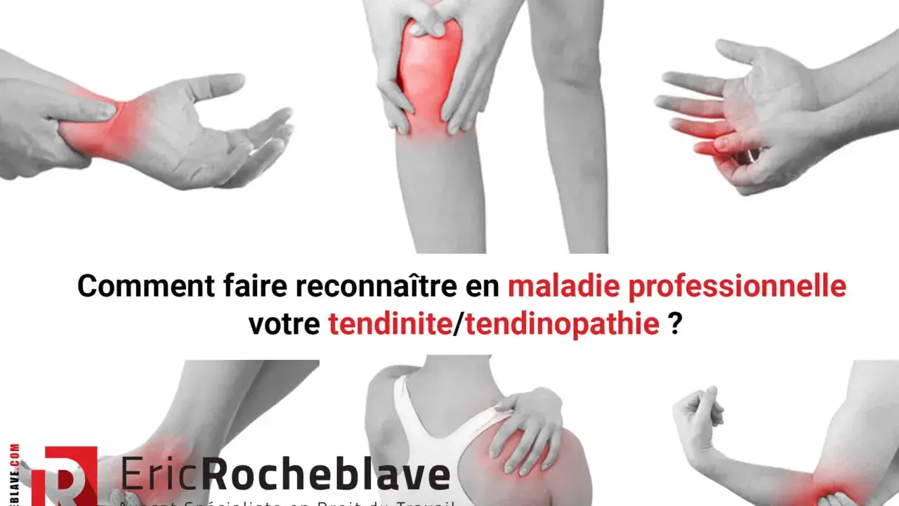 Douleurs articulaires (poignet, genou, doigt, épaule, coude) : comment faire reconnaître votre tendinite en maladie professionnelle.