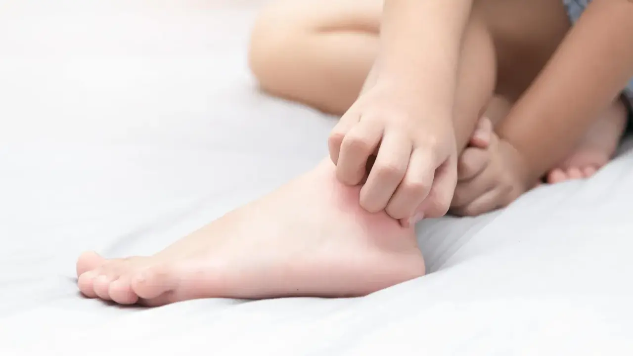 Un enfant se gratte les jambes qui démangent le soir, cherchant un peu de répit avant de dormir.