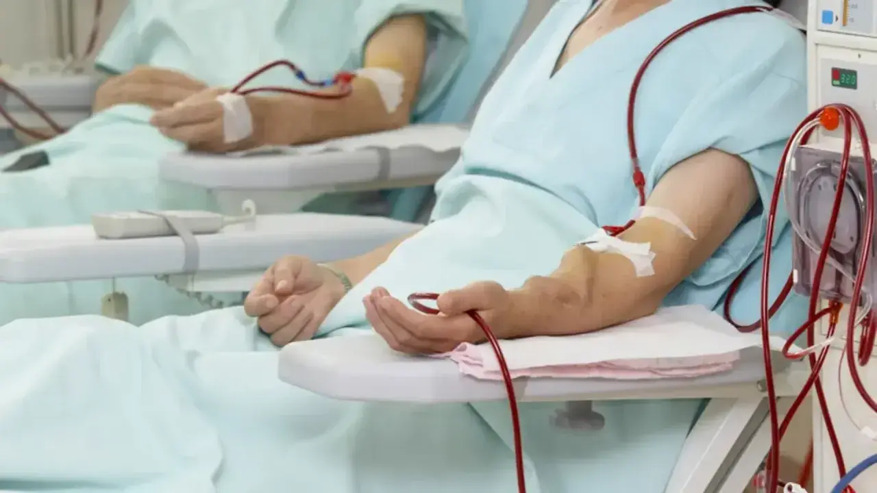 Pacjenci podłączeni do aparatury dializacyjnej. Czy dializa boli? To zależy od indywidualnego progu bólu i rodzaju zabiegu.